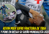 Kevin Mier sufre fractura y peligra su Mundial 2026 Kevin Mier