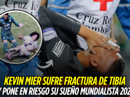 Kevin Mier sufre fractura y peligra su Mundial 2026 Kevin Mier